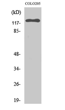 EphB6 rabbit pAb Antibody