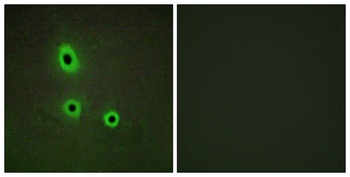 Ephrin-A5 rabbit pAb Antibody