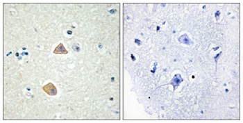 Ephrin-A5 rabbit pAb Antibody