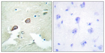 ErbB-3 rabbit pAb Antibody