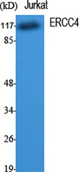 ERCC4 rabbit pAb