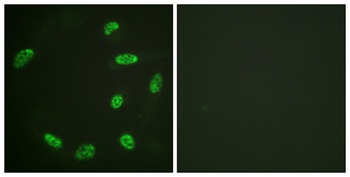 ERF rabbit pAb Antibody