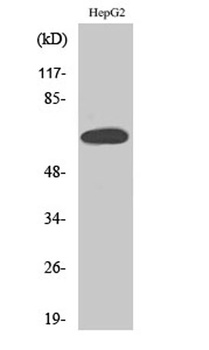 ERα rabbit pAb Antibody