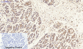 ERβ rabbit pAb Antibody