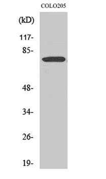 EWS rabbit pAb Antibody