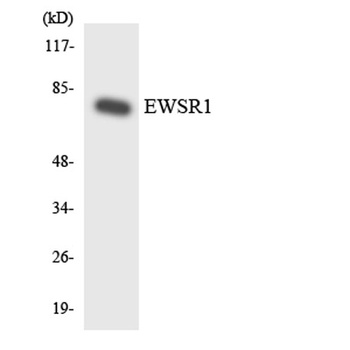 EWS rabbit pAb Antibody