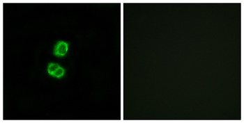 FGF-22 rabbit pAb Antibody