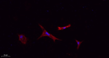 FN1 rabbit pAb Antibody