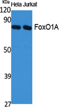 FoxO1A rabbit pAb Antibody