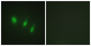 FoxO4 rabbit pAb Antibody