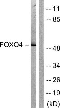 FoxO4 rabbit pAb Antibody