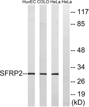 FRP-2 rabbit pAb Antibody
