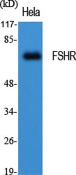 FSHR antibody