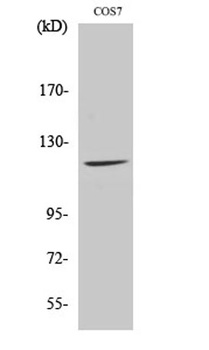 Fucokinase antibody