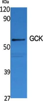 GCK antibody