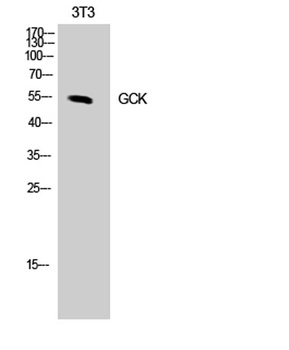 GCK rabbit pAb Antibody