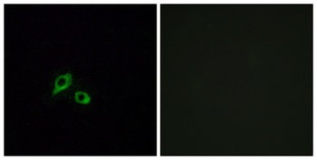 GIPR rabbit pAb Antibody