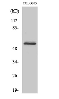 Glucagon Receptor rabbit pAb Antibody