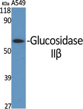 Glucosidase II beta antibody