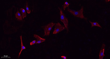 Glut1 rabbit pAb