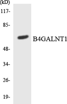 GM2/GD2 synthase rabbit pAb Antibody