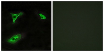 GPR116 rabbit pAb Antibody