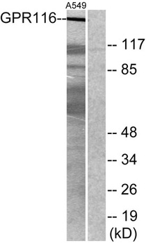 GPR116 rabbit pAb Antibody