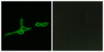 GPR15 rabbit pAb Antibody