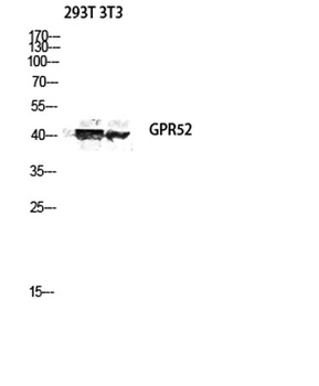 GPR52 rabbit pAb Antibody