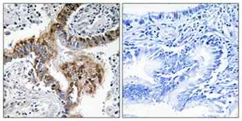 GRK 2 rabbit pAb Antibody
