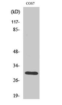 HCCS antibody