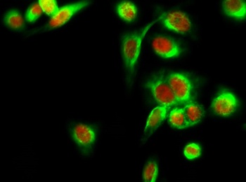 HDAC6 antibody