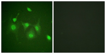 HDAC6 rabbit pAb Antibody