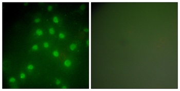 Histone deacetylase 9 rabbit pAb Antibody