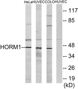 HORMAD1 rabbit pAb Antibody