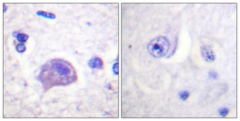 Hrs rabbit pAb Antibody