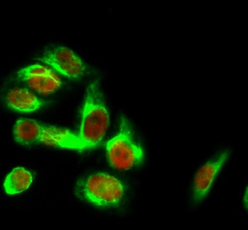 HSP40 antibody