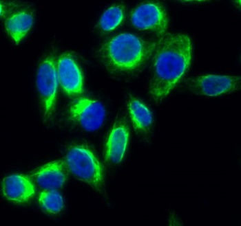 HSP60 rabbit pAb
