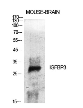 IGFBP3 antibody