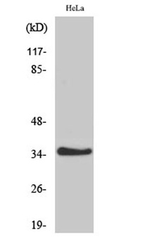 IL20R beta antibody