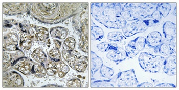 INSL4 rabbit pAb Antibody