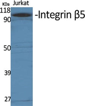 Integrin beta 5 antibody