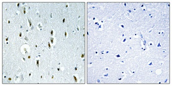 IP6K2 rabbit pAb Antibody