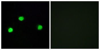 IP6K2 rabbit pAb Antibody
