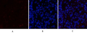 JAK2 antibody