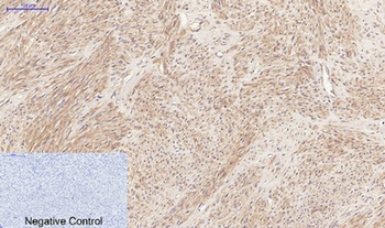JAK2 rabbit pAb Antibody
