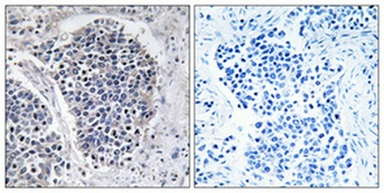 JIP-3 rabbit pAb Antibody