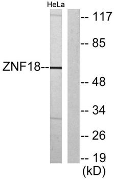 KOX11 rabbit pAb Antibody