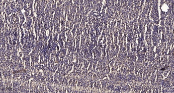KOX11 rabbit pAb Antibody