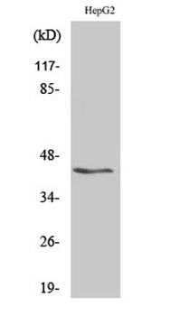 KV beta.3 antibody